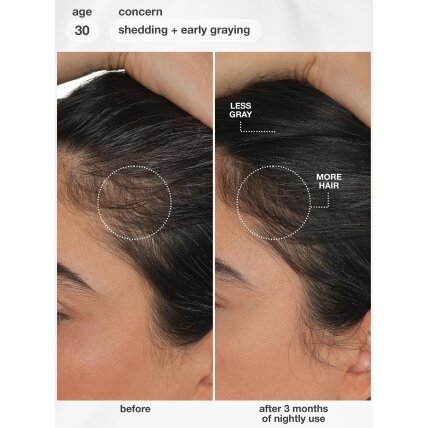 K18 FutureIQ™ biomimetinis plaukų ilgaamžiškumo serumas, 90 ml 2