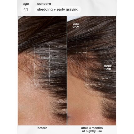 K18 FutureIQ™ biomimetinis plaukų ilgaamžiškumo serumas, 90 ml 3